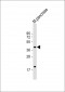 GMPPB Antibody (Center)